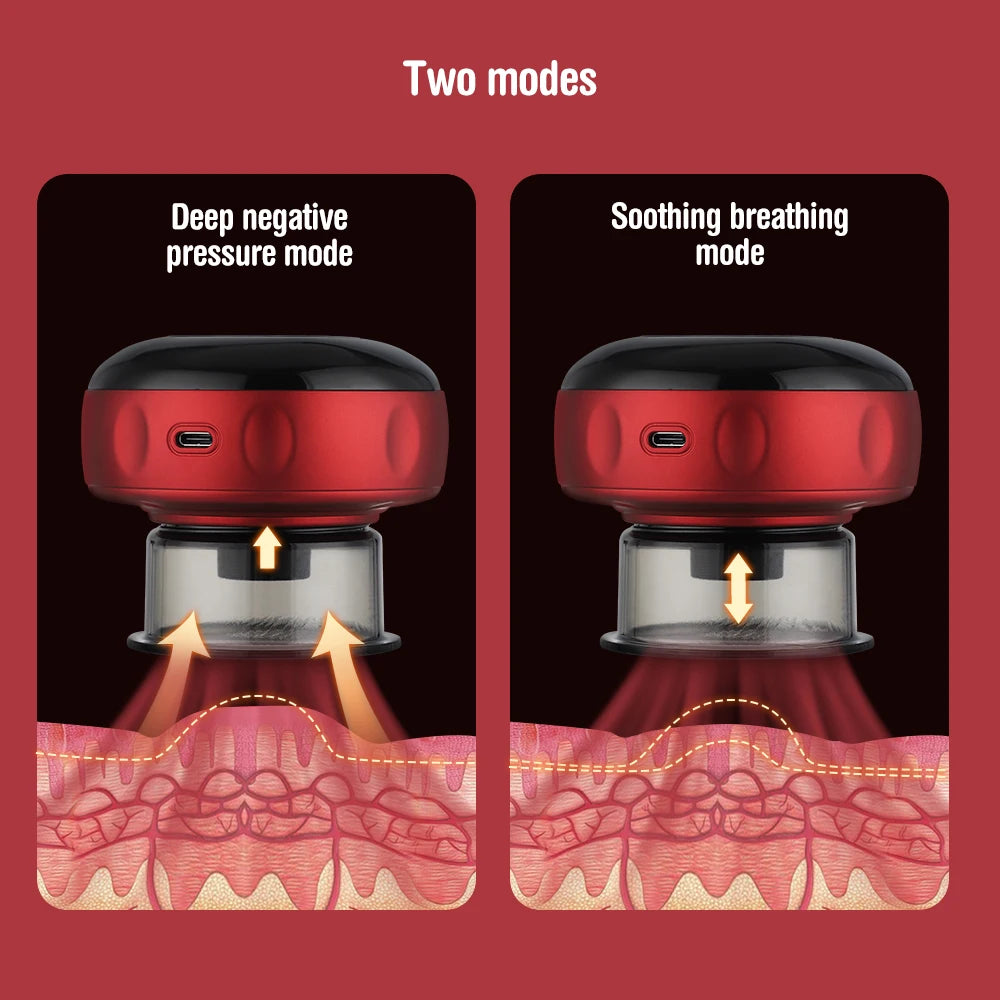 Revolutionary Smart Electric Body Cupping Massager with Heating & Suction for Ultimate Relaxation